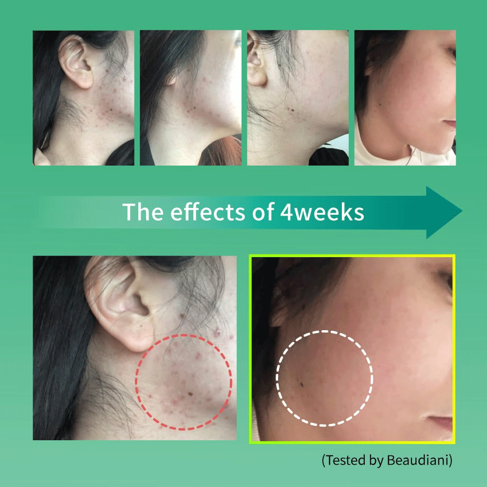 BEAUDIANI Cica Ampoule Mask 100 pads - DODOSKIN