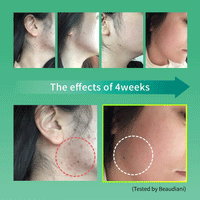 BEAUDIANI Cica Ampoule Mask 100 pads - DODOSKIN