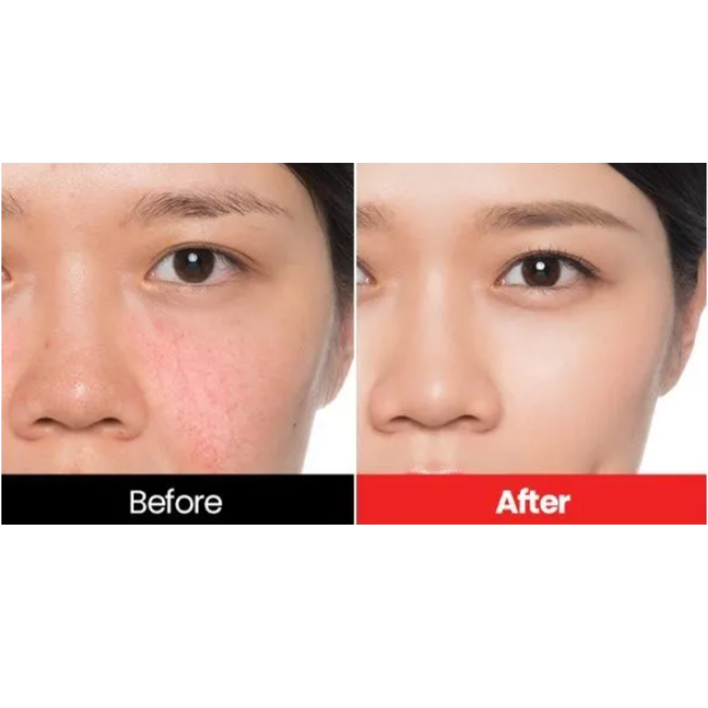 Dr.want Red Cover Cream 17g - DODOSKIN