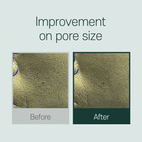 THE FACE SHOP Tea Tree Pore Ampoule 30ml - DODOSKIN