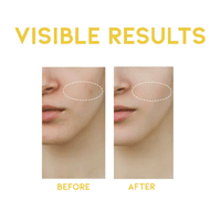 OOTD Dark Spot Vitamin C Serum 50ml - DODOSKIN