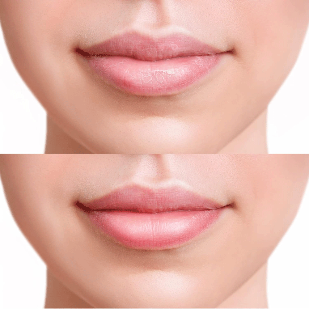 FRUDIA Blueberry Hydrating Honey Lip Balm 10g - DODOSKIN