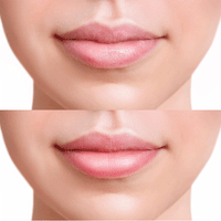 FRUDIA Blueberry Hydrating Honey Lip Balm 10g - DODOSKIN