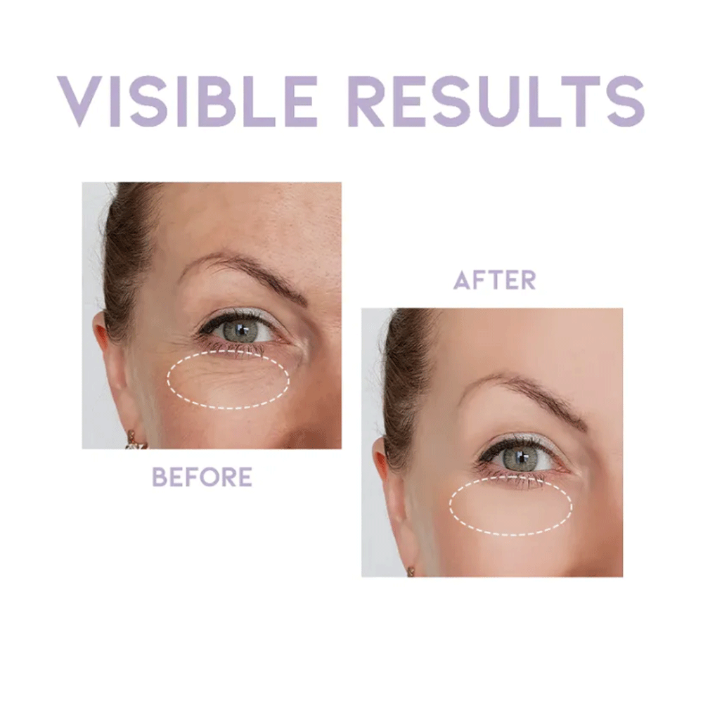 OOTD Overnight Eye Cream P.M 25g - DODOSKIN