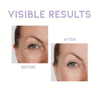 OOTD Overnight Eye Cream P.M 25g - DODOSKIN