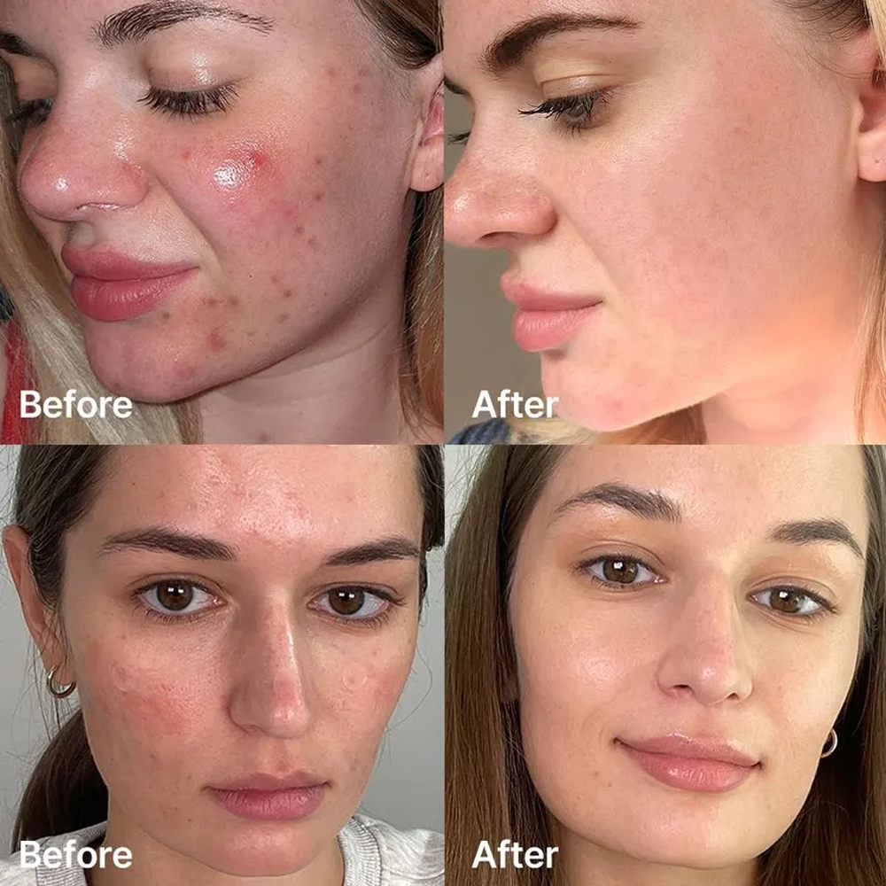 MEDICUBE Red Succinic Acid Serum 30ml