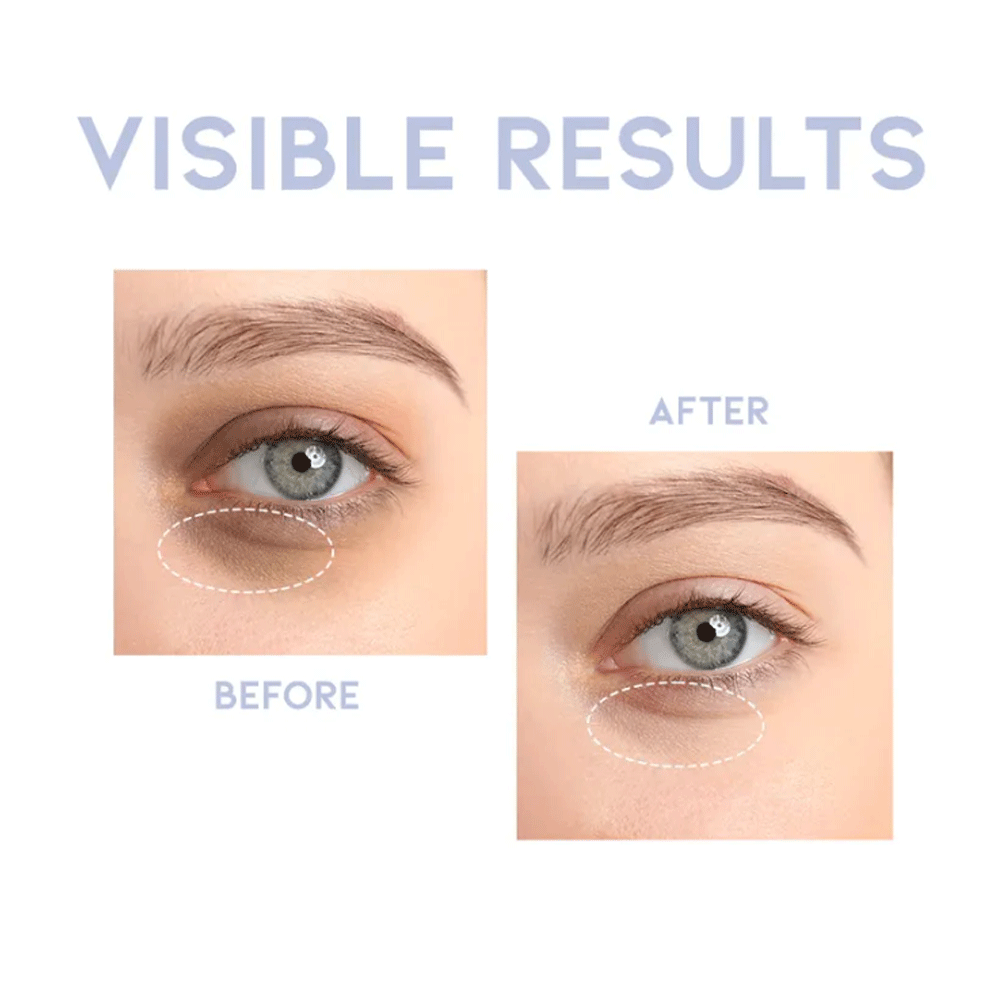 OOTD Intensive Eye Serum A.M 30g - DODOSKIN