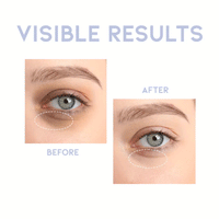 OOTD Intensive Eye Serum A.M 30g - DODOSKIN