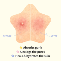 (NEWA) OOTD Star Spot Patch 80 patches - DODOSKIN