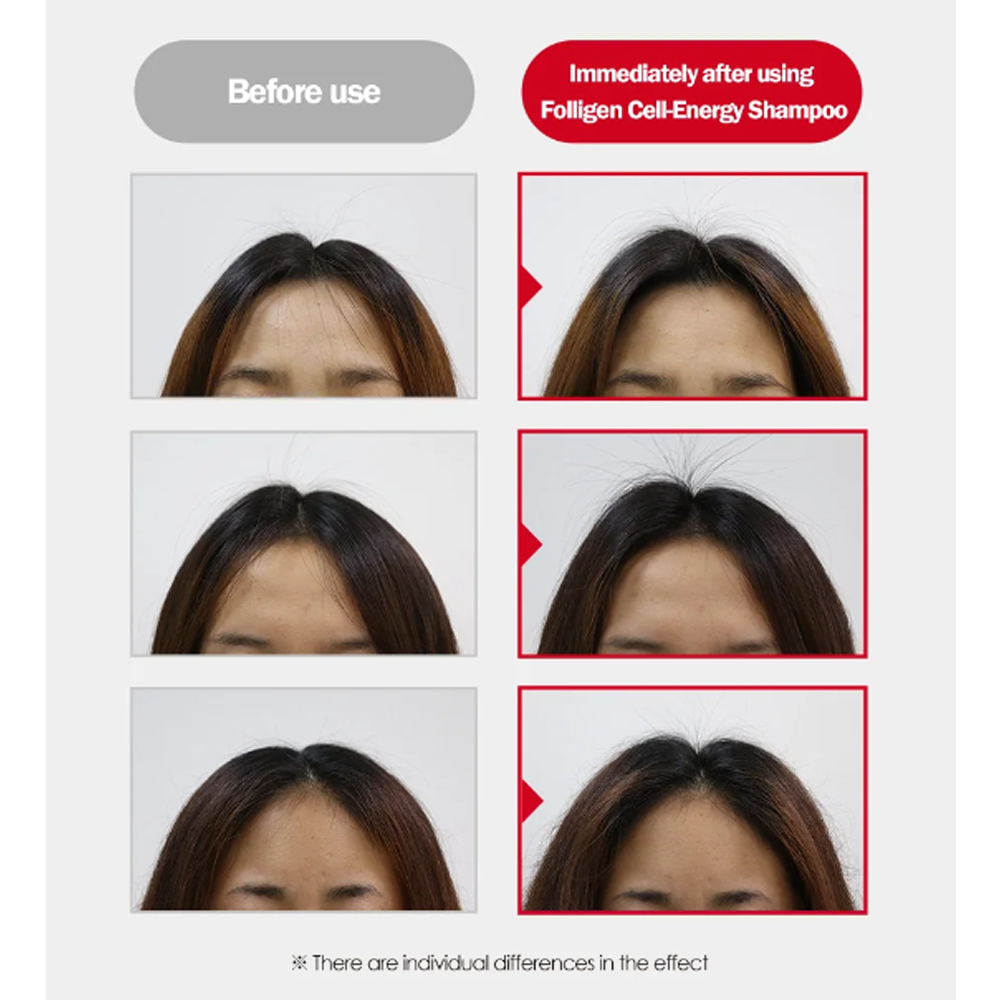 Dr.FORHAIR Folligen Cell-Energy Shampoo 500mL - DODOSKIN