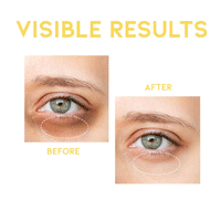 OOTD Dark Circle Eye Serum 30g - DODOSKIN