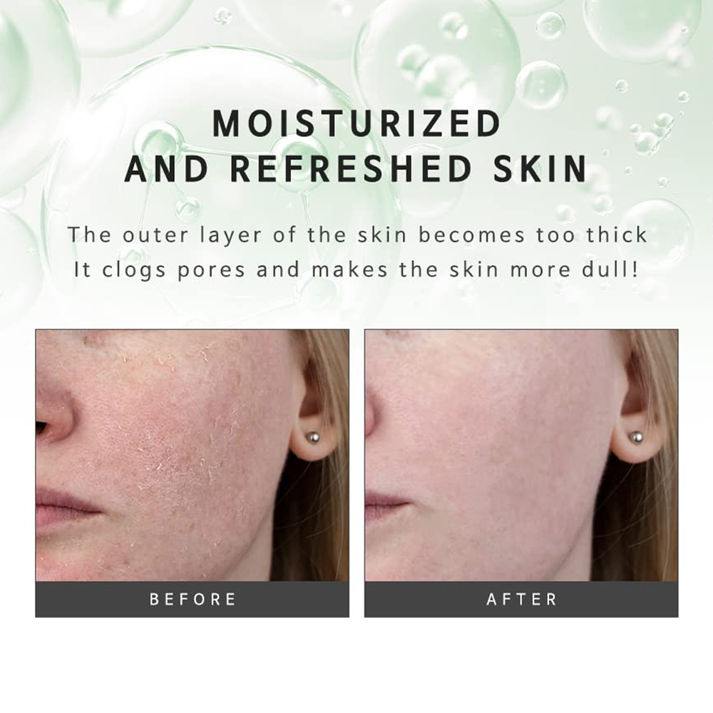 KLAVUU Phytoncide Peeling Gel 80ml - DODOSKIN