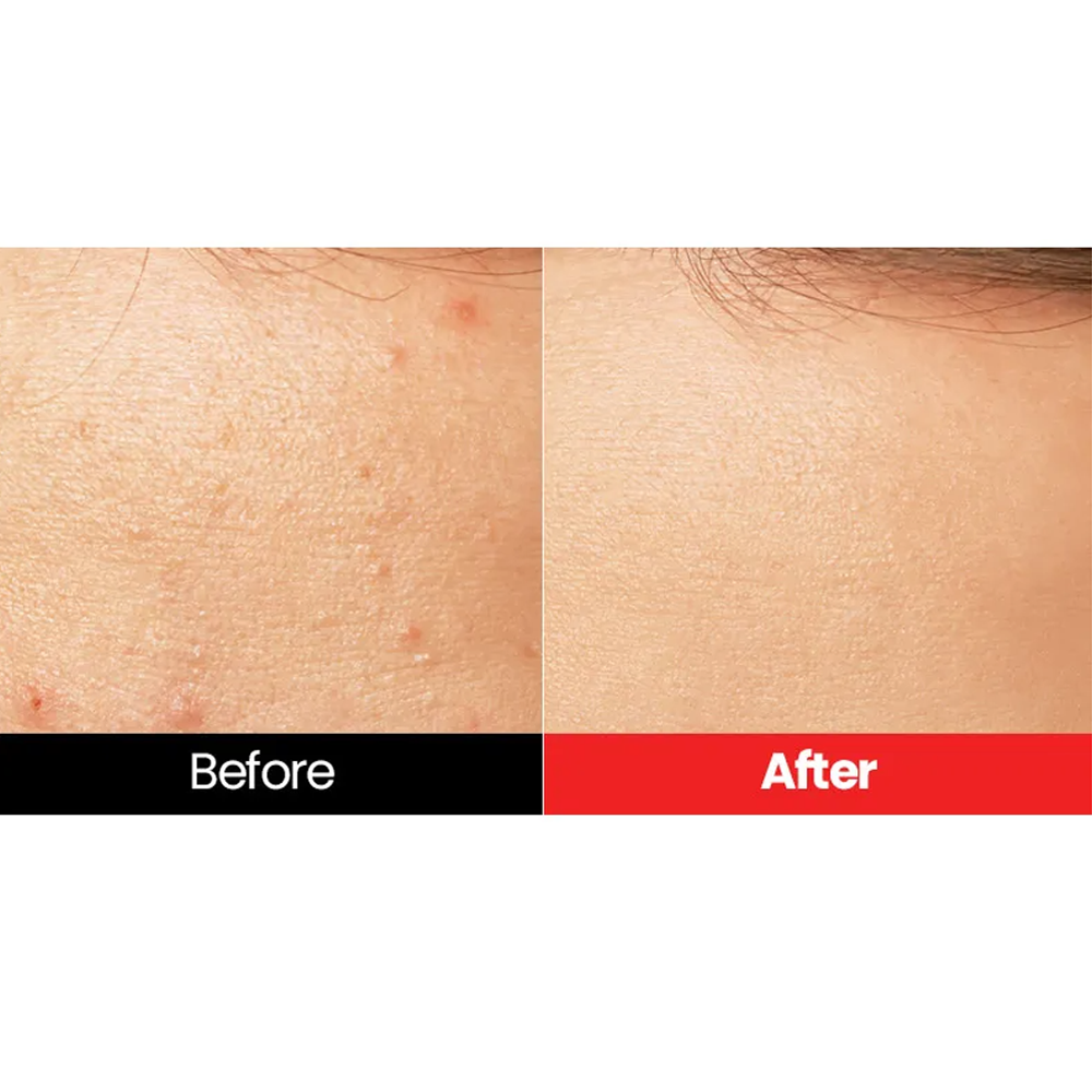 Dr.want Red Pore Pad 70 pads - DODOSKIN