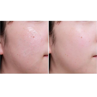 TOSOWOONG SOS Tightening Pore Clinic Pore Tight Sleeping Pack 50g - DODOSKIN