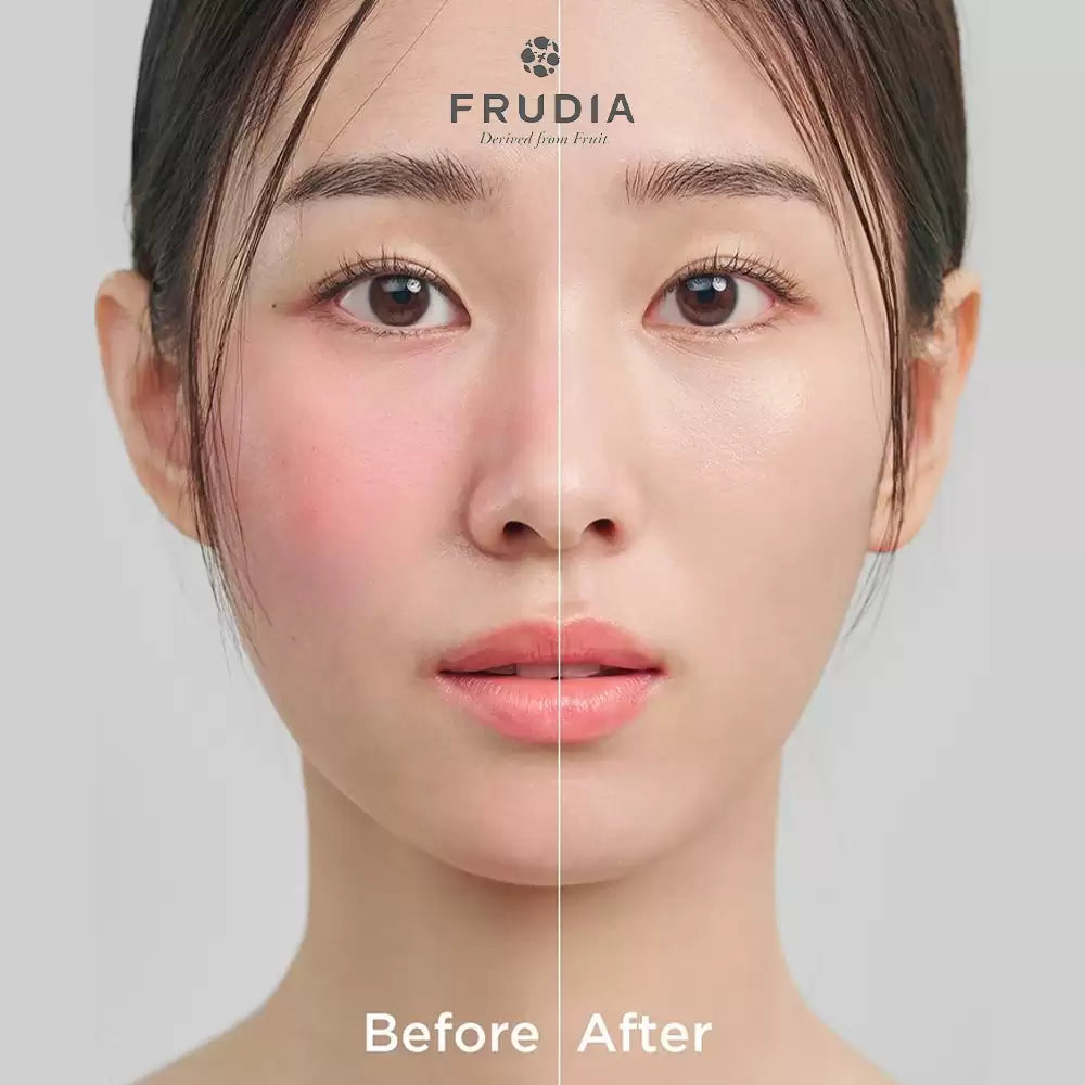 FRUDIA Re:Proust Essential Blemish Recovery Balm SPF50+ 40g - DODOSKIN