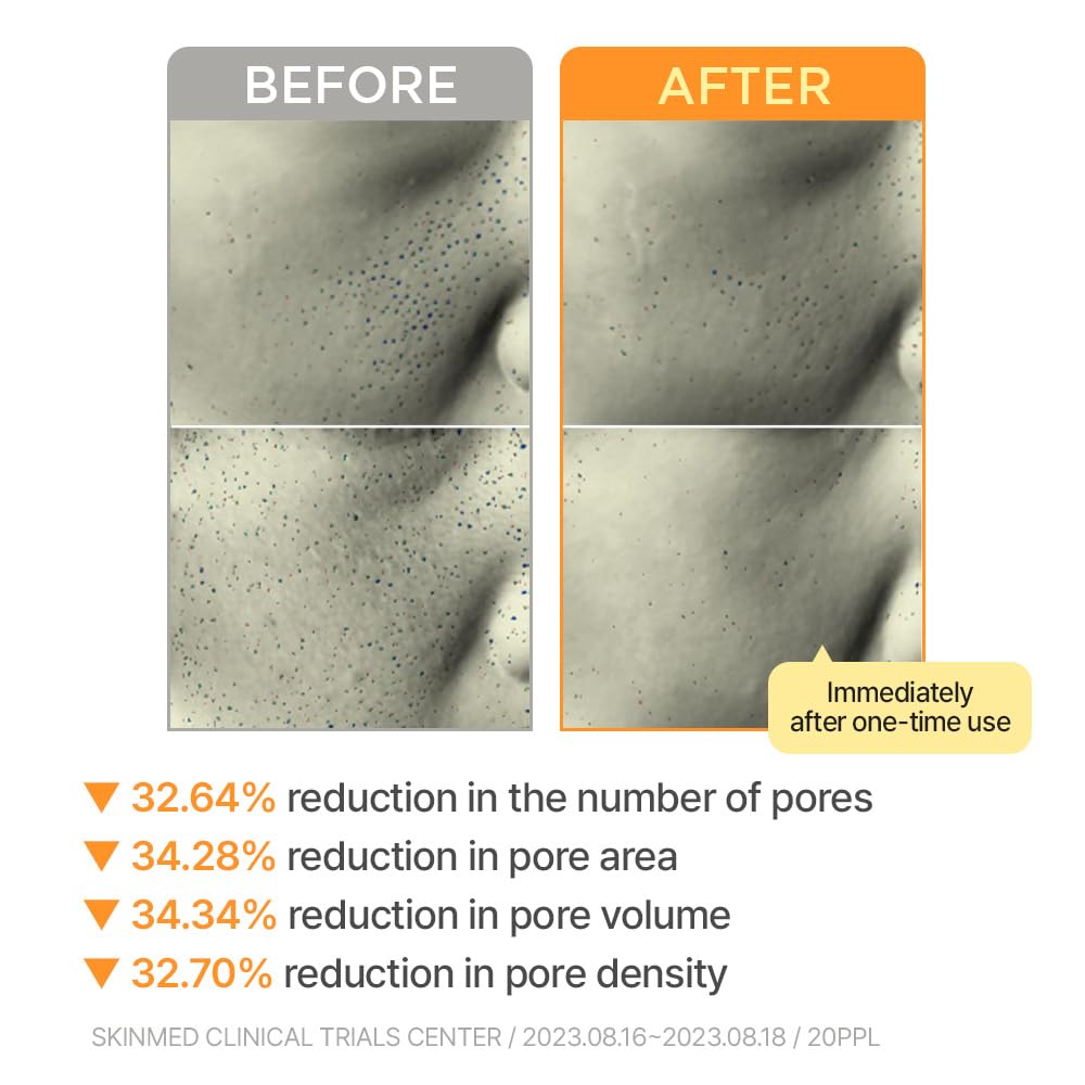 AIPPO Expert Pore Ampoule Mask 30ml