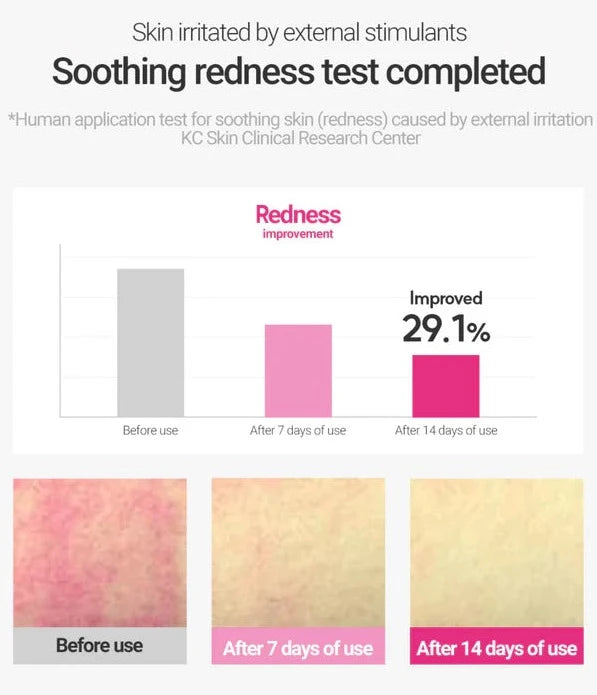 (Matthew) ROVECTIN Cica Care Blemish Clearing Cream 50ml - DODOSKIN