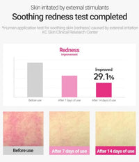 (Matthew) ROVECTIN Cica Care Blemish Clearing Cream 50ml - DODOSKIN