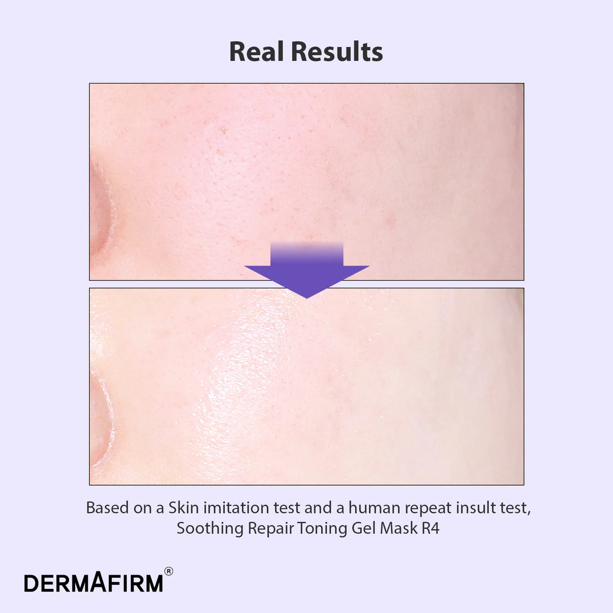 DERMAFIRM Soothing Repair Toning Gel Mask R4 (4 Sheet)
