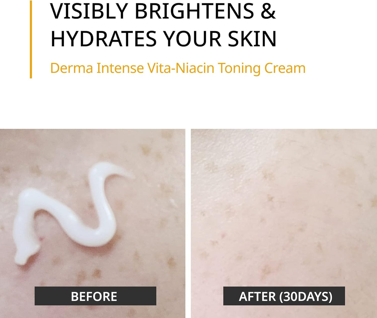 FORETDERM. Derma Intense Vita-Niacin Toning Cream 20ml