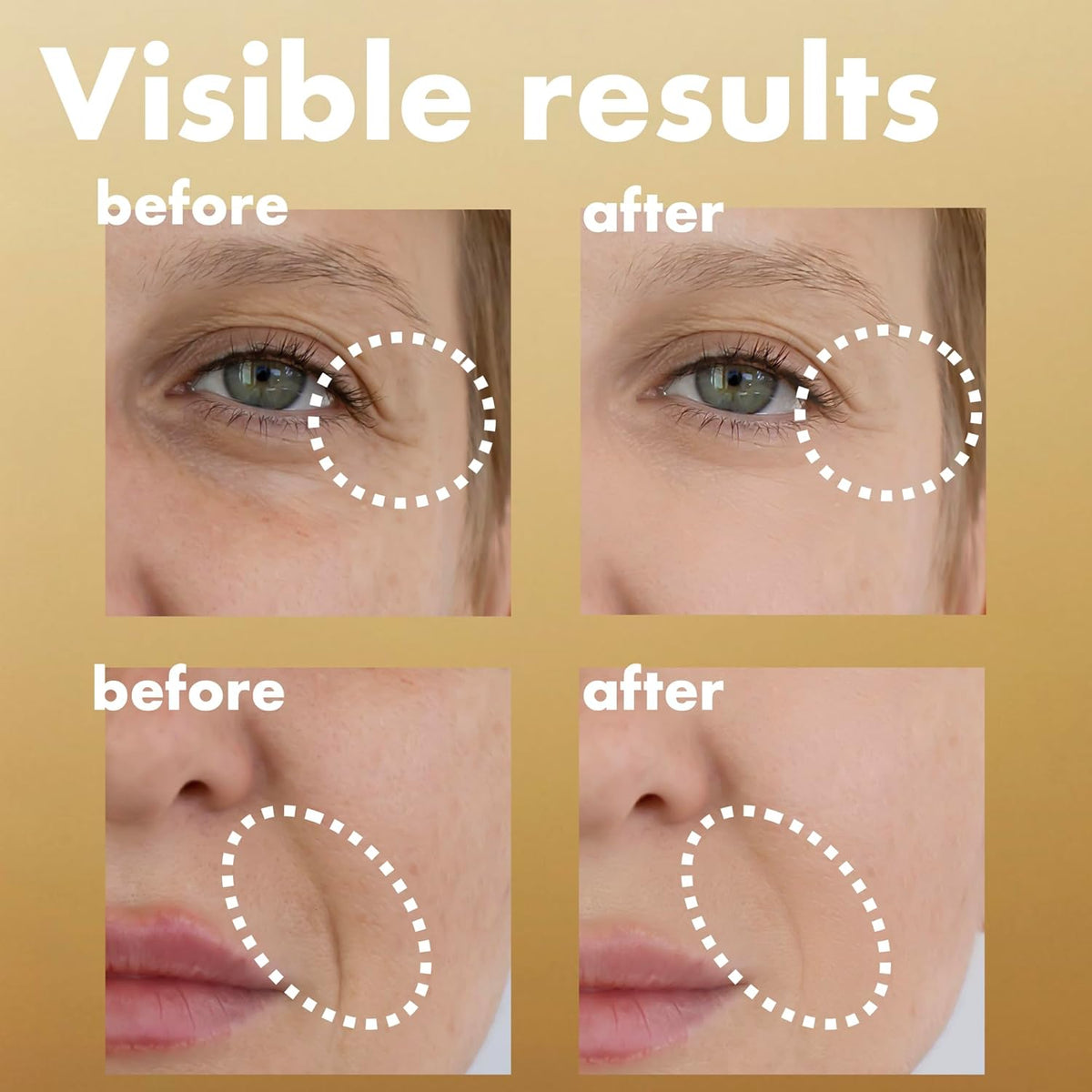 ISOI Intensive Energizing Cream EX 35ml