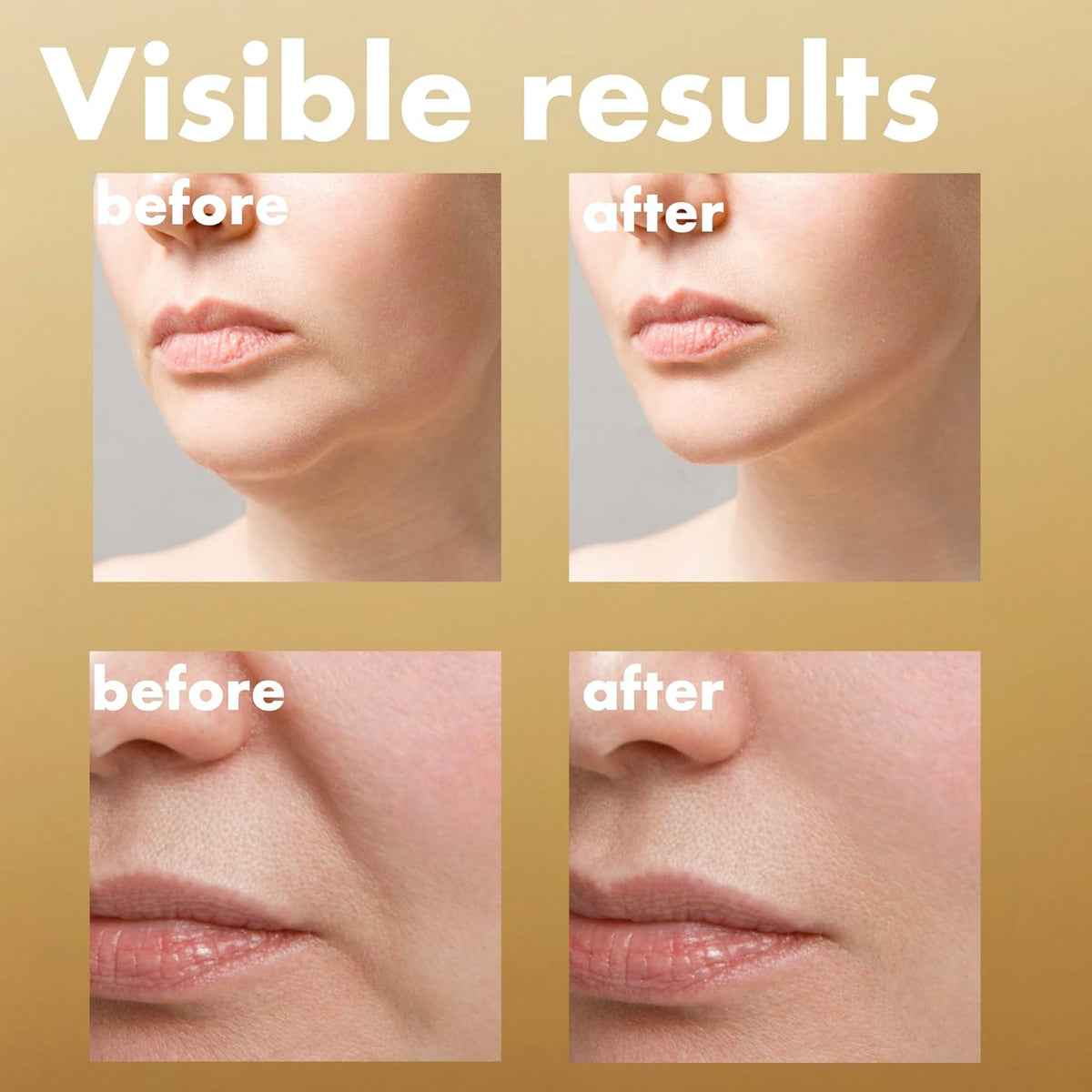 ISOI Intensive Lifting & Firming Serum 35ml