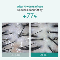 lilyeve Scalp:Turn Cica PDRN Brush Ampoule 100ml