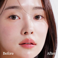 Natural Derma Project Ha Boosting Serum 30ml