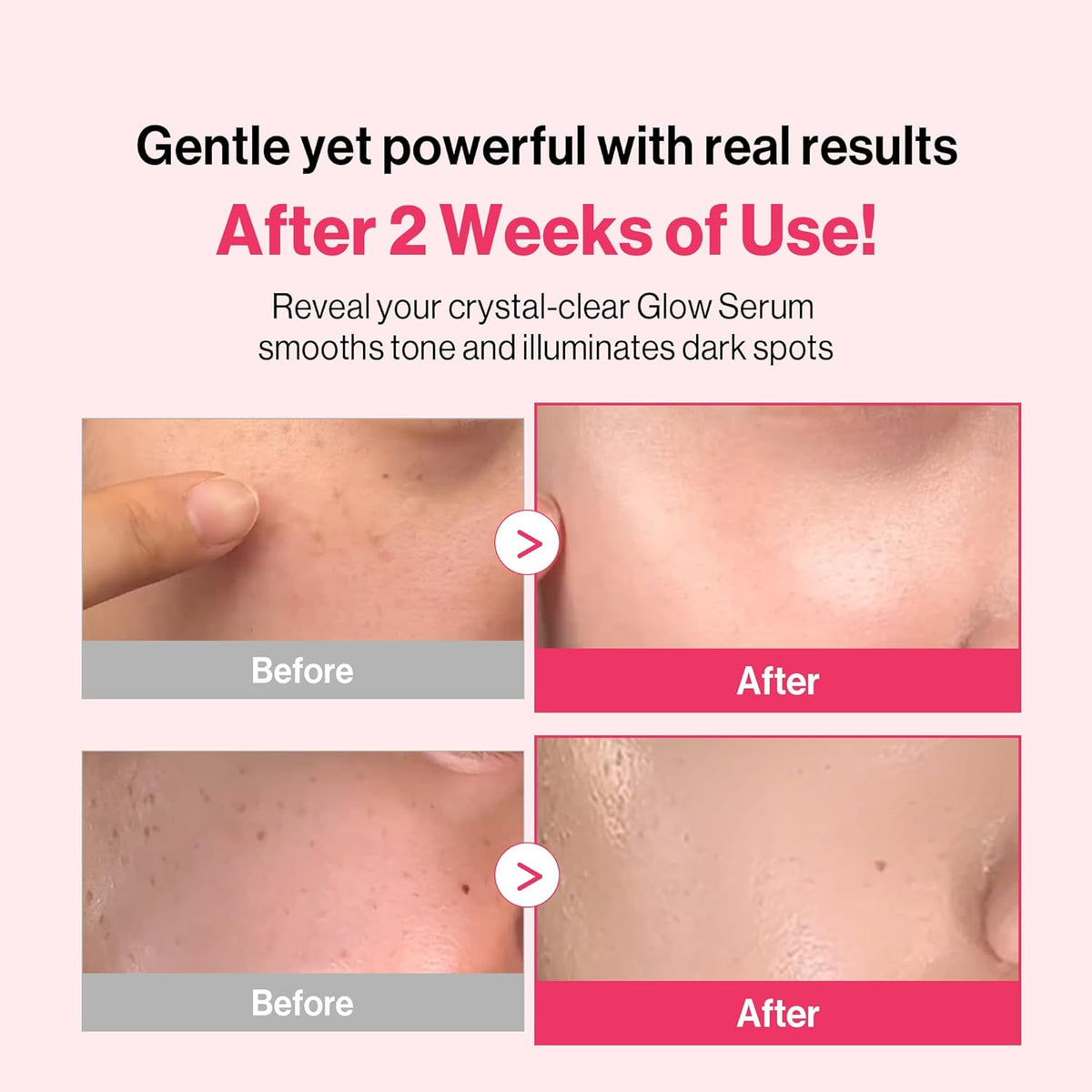 Re:dence Tone & Spot Corrector Ampoule 30ml