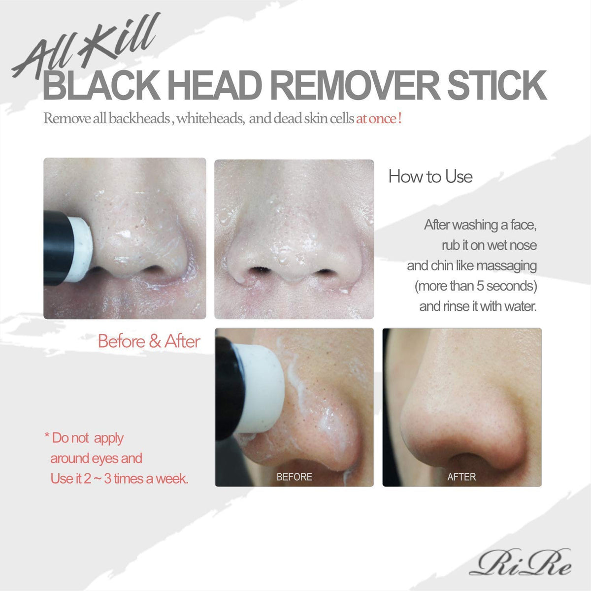 RiRe All Kill Blackhead Remover Stick 10g