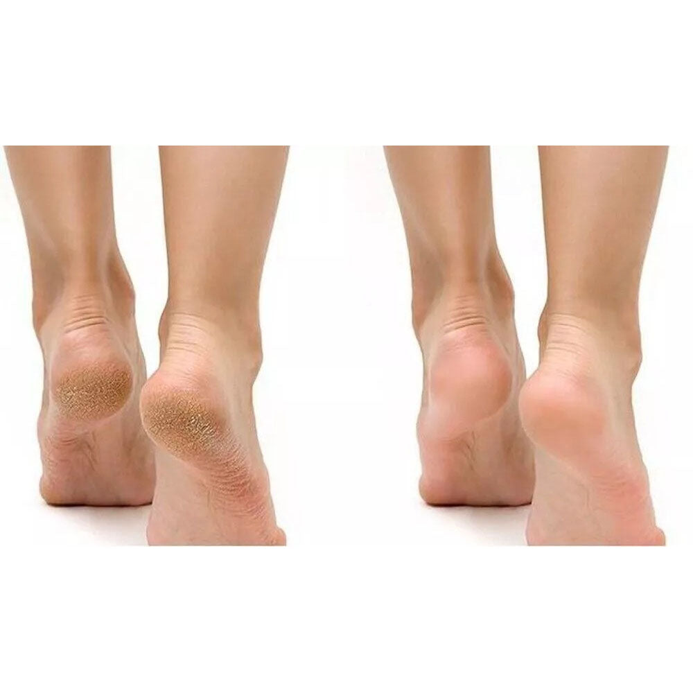 SOOBLANC Dreamy Purifying Peeling Gel 150ml