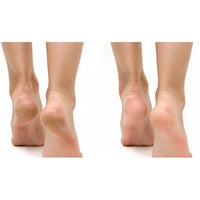 SOOBLANC Dreamy Purifying Peeling Gel 150ml