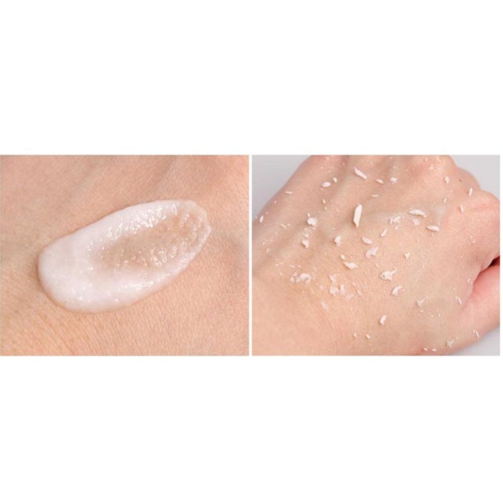 Sidmool LHA Irregularities Zero Peeling Gel 120ml