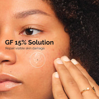 The Ordinary GF 15% Solución 30 ml