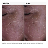 The Ordinary GF 15% Solución 30 ml