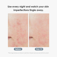 glowiest Epolisse Glow PDRN Spicule Glow Cream 30ml