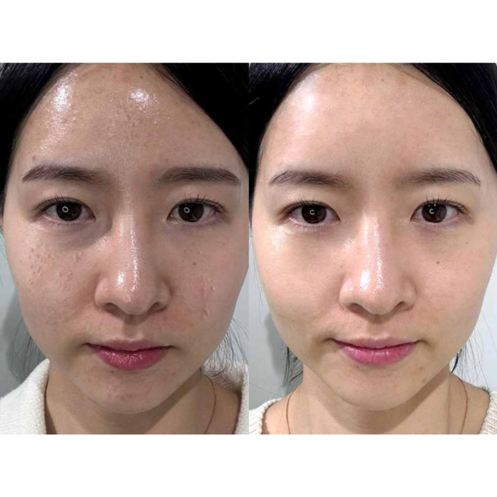 mommy care Job's Tears Powder Enzyme Facial Cleanser 50g