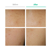 Dewytree AC CTRL EX Deep Repair Blemish Mask Sheet 10ea