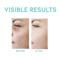 OOTD Wrinkle Lift Retinol Serum 50ml - DODOSKIN