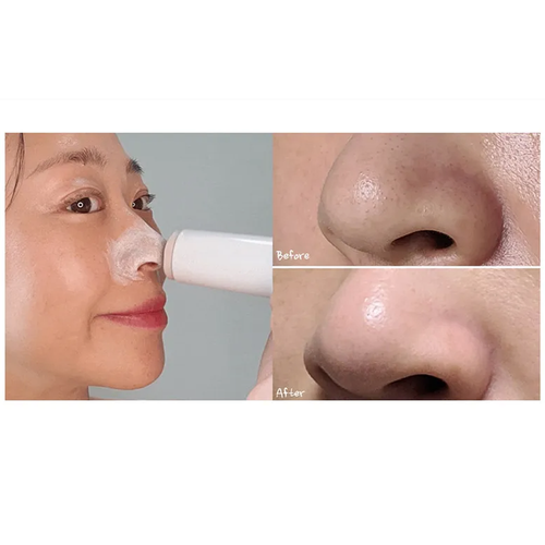 MEDI-PEEL Extra Super 9 Plus Active Stick 33g - DODOSKIN