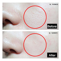 TOSOWOONG Platinum Miracle Pore Tightening Pack 150ml - DODOSKIN