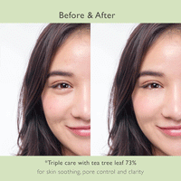 NOWATER Prestige73 Teatree Mask 70g - DODOSKIN