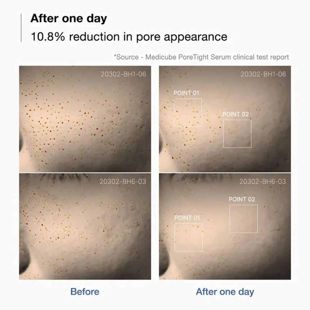 MEDICUBE Zero Pore One Day Serum 30ml - DODOSKIN