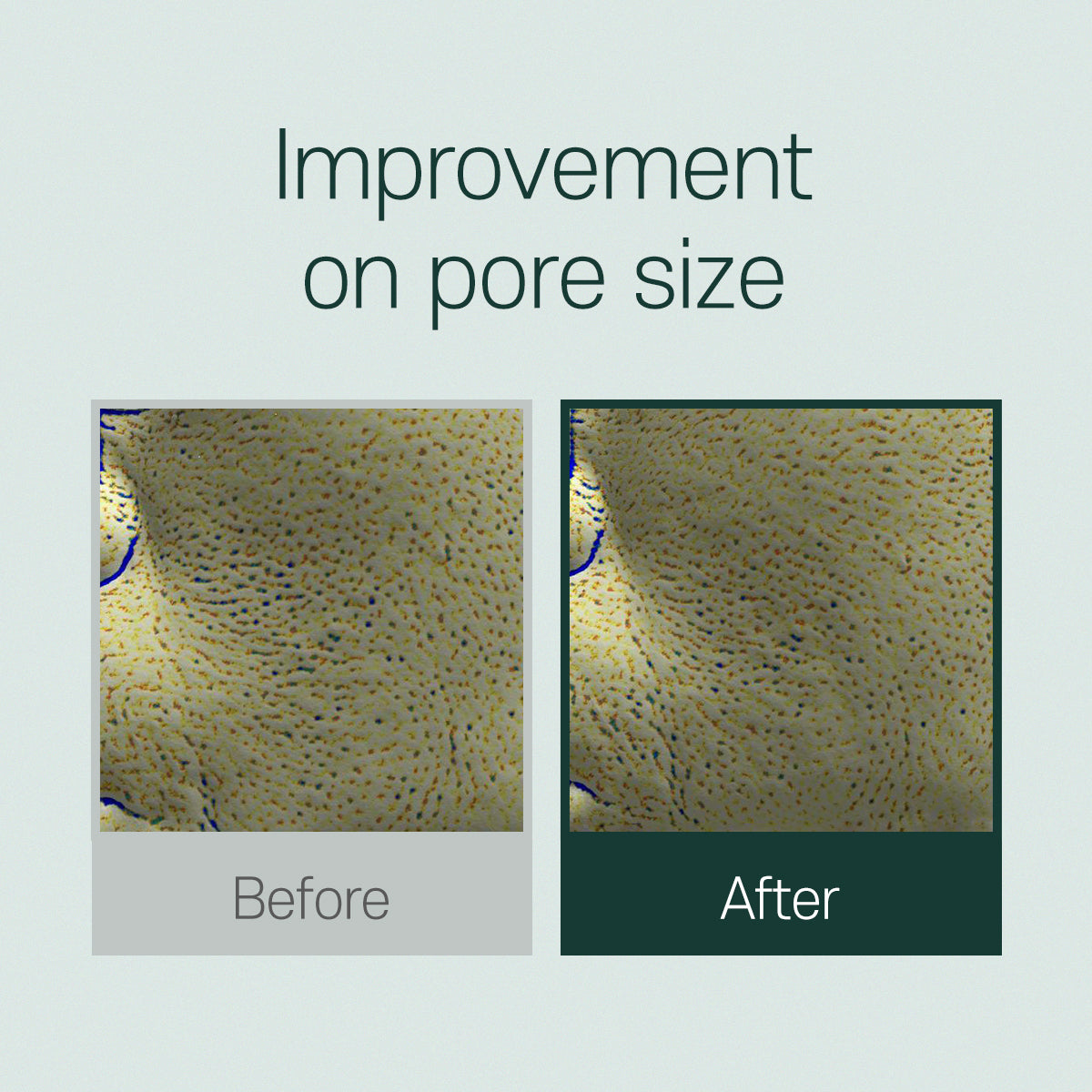 THE FACE SHOP Tea Tree Pore Ampoule 30ml - DODOSKIN