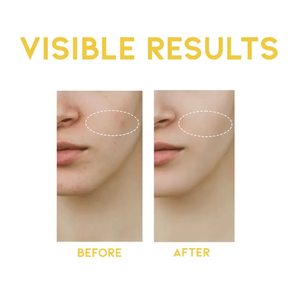 OOTD Dark Spot Vitamin C Serum 50ml - DODOSKIN