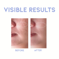 OOTD Collagen Plumping Toner A.M 250ml - DODOSKIN