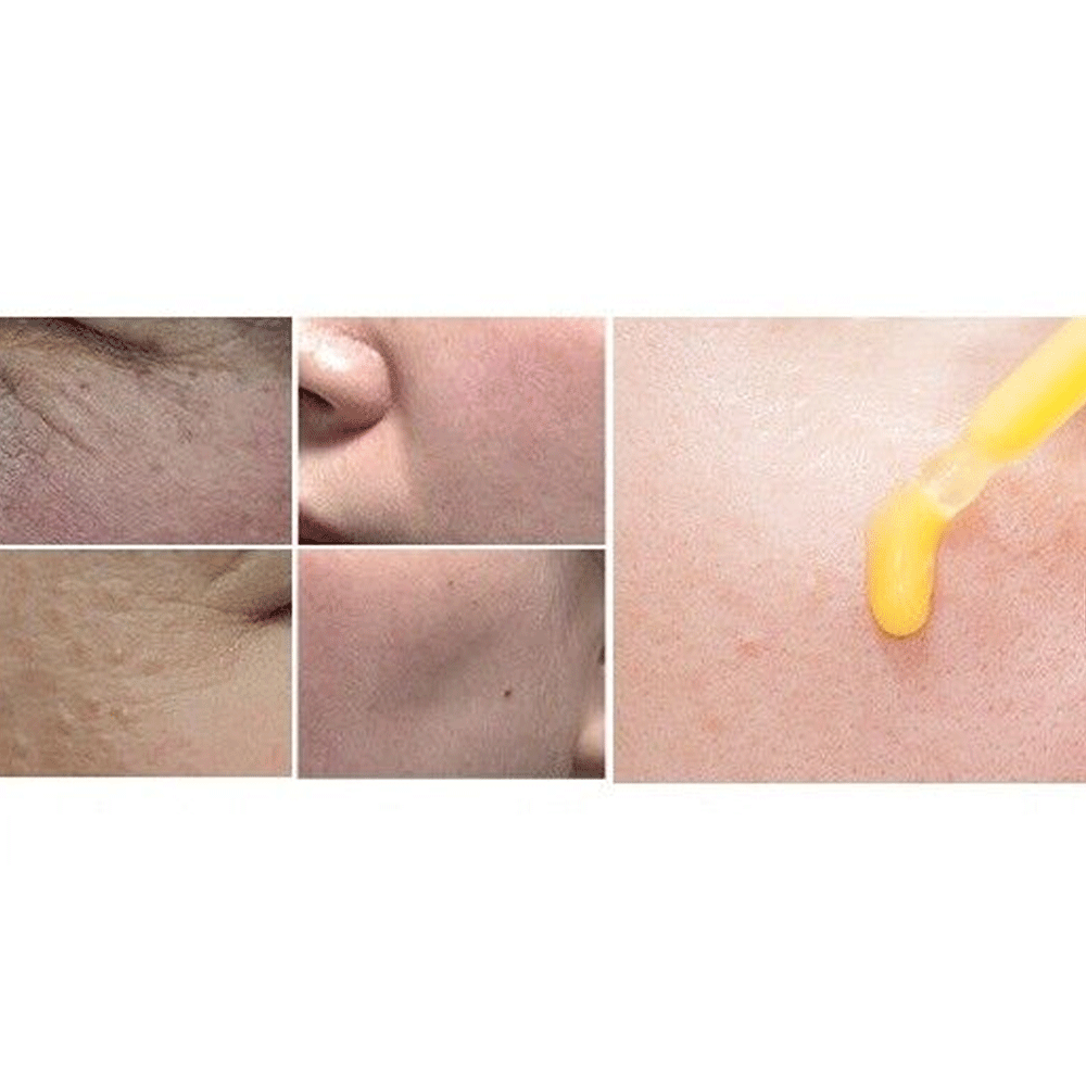 Sidmool Idebenone Elasticity Ampoule 32ml - DODOSKIN