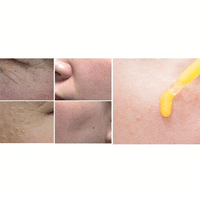 Sidmool Idebenone Elasticity Ampoule 32ml - DODOSKIN