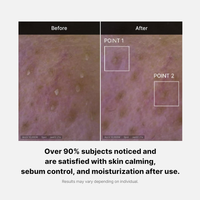 MEDICUBE Red Foam Cleanser 120ml - DODOSKIN