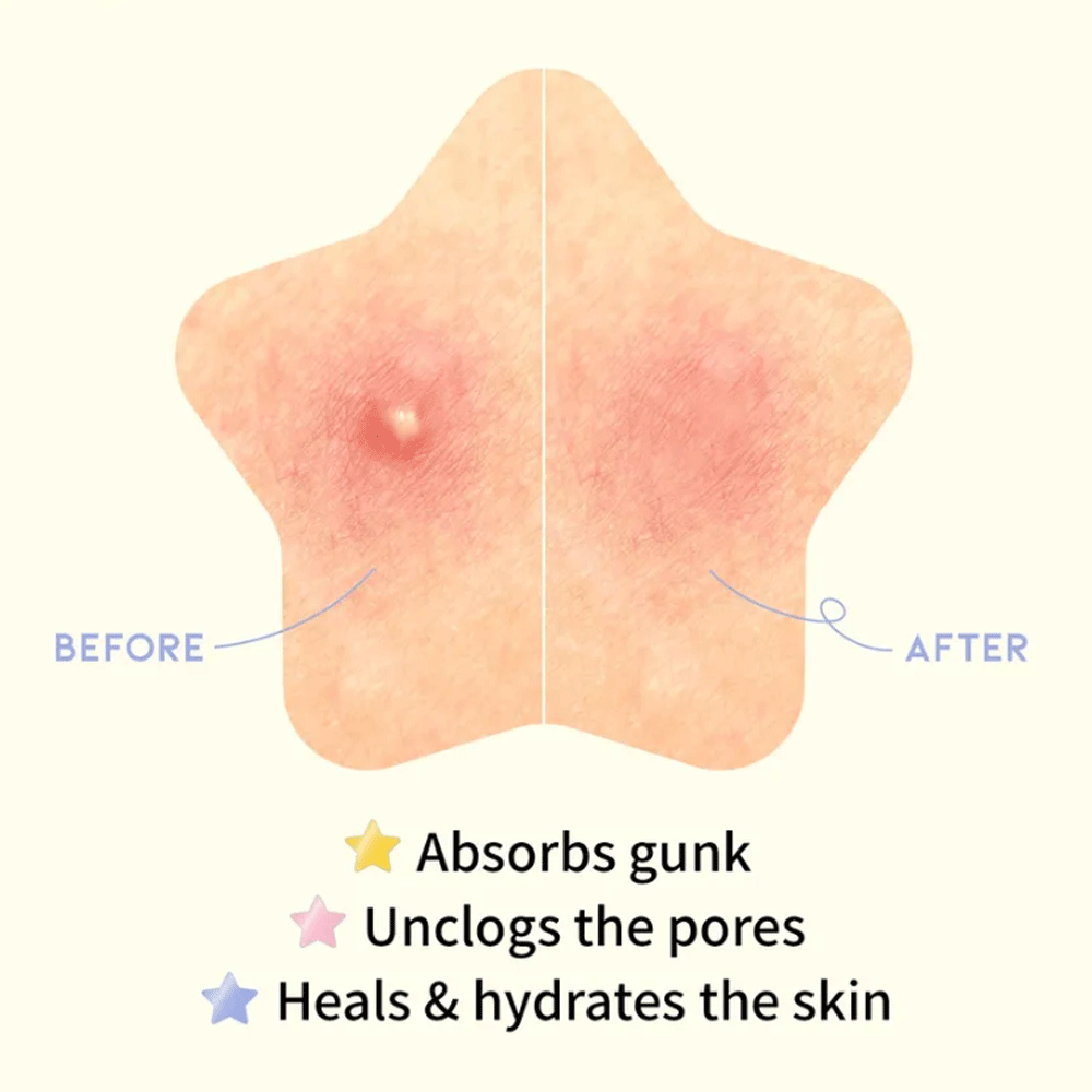 (NEWA) OOTD Star Spot Patch 80 patches - DODOSKIN